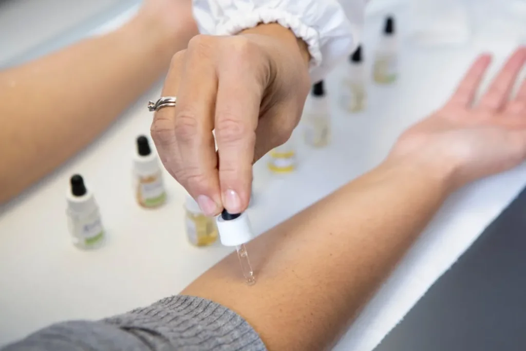 Imagen de pruebas de alergia